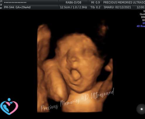 3d ultrasound at 20 weeks pregnant